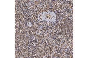 IHC analysis of SFXN3 using anti-SFXN3 antibody (ABIN7601302). (SFXN3 antibody  (AA 32-321))