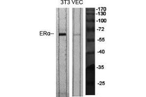 Western Blot (WB) analysis of specific cells using ERalpha Polyclonal Antibody. (Estrogen Receptor alpha antibody  (Ser364))