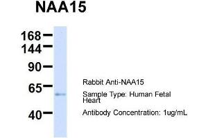 Host:  Rabbit  Target Name:  NAA15  Sample Type:  Human Fetal Heart  Antibody Dilution:  1. (NAA15 antibody  (N-Term))