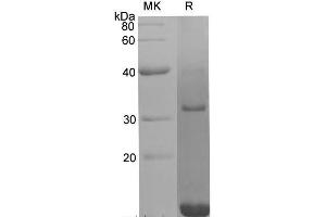 Western Blotting (WB) image for Platelet Derived Growth Factor Subunit B (PDGFB) protein (His tag) (ABIN7321293)