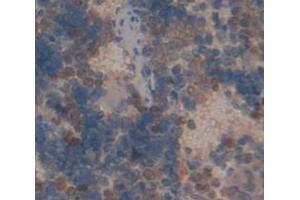 IHC-P analysis of Rat Tissue, with DAB staining. (TRADD antibody  (AA 24-261))