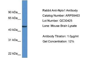 Western Blotting (WB) image for anti-Neuronal Pentraxin 1 (NPX1) (Middle Region) antibody (ABIN786031) (NPX1 antibody  (Middle Region))