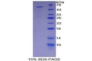 SDS-PAGE analysis of Mouse MYH2 Protein. (MYH2 Protein)