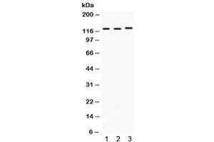 Western blot testing of 1) rat heart, 2) mouse brain, and 3) human A549 lysate with CRM1 antibody. (XPO1 antibody)