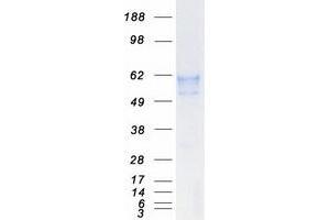 Western Blotting (WB) image for Beta-secretase 1 (BACE1) (Transcript Variant A) protein (Myc-DYKDDDDK Tag) (ABIN2715129)