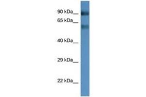 Image no. 1 for anti-Solute Carrier Family 6 (Neutral Amino Acid Transporter), Member 15 (SLC6A15) (AA 400-449) antibody (ABIN6746236) (SLC6A15 antibody  (AA 400-449))