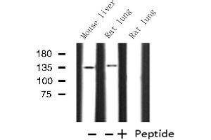 Western blot analysis of Histone KPB1/2 expression in various lysates (KPB1/2 antibody)