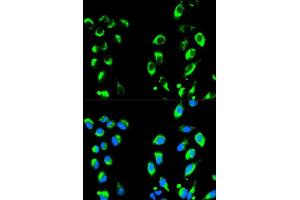Immunofluorescence analysis of HeLa cell using NFKBIA antibody. (NFKBIA antibody  (AA 1-317))
