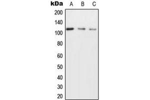 Western blot analysis of NICE4 expression in MCF7 (A), SP2/0 (B), H9C2 (C) whole cell lysates. (UBAP2L antibody  (Center))