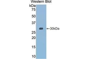 Western blot analysis of the recombinant protein. (GZMK antibody  (AA 27-264))