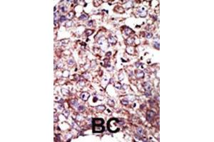 Immunohistochemistry (IHC) image for anti-Farnesyltransferase, CAAX Box, alpha (FNTA) antibody (ABIN3001525) (FNTA antibody)