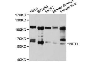Western blot analysis of extracts of various cell lines, using NET1 antibody (ABIN5970555) at 1/1000 dilution. (NET1 antibody)