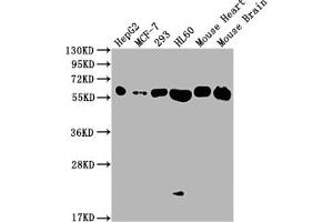 Western Blot Positive WB detected in: HepG2 whole cell lysate, MCF-7 whole cell lysate, 293 whole cell lysate, HL60 whole cell lysate, Mouse Heart tissue, Mouse Brain tissue All lanes: ATP5F1A antibody at 1:2000 Secondary Goat polyclonal to rabbit IgG at 1/50000 dilution Predicted band size: 60, 55, 58 kDa Observed band size: 60 kDa (Recombinant ATP5A1 antibody)