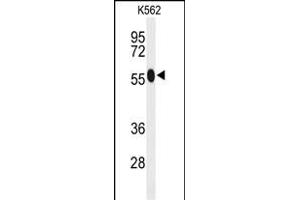 Western blot analysis of ACSM1 Antibody (N-term) (ABIN653232 and ABIN2842765) in K562 cell line lysates (35 μg/lane). (ACSM1 antibody  (N-Term))