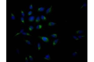 Immunofluorescence staining of Hela Cells with ABIN7127338 at 1:50, counter-stained with DAPI. (Recombinant APP antibody)