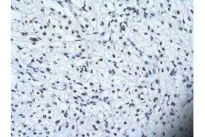 Immunohistochemistry (IHC) image for anti-Homeodomain Interacting Protein Kinase 2 (HIPK2) (Middle Region) antibody (ABIN2779735)