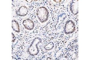 IHC analysis of ADK using anti-ADK antibody (ABIN4886430). (ADK antibody  (AA 165-351))