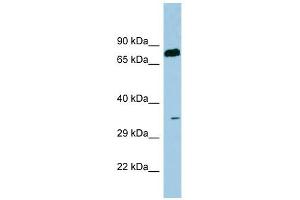 SDS antibody used at 1 ug/ml to detect target protein. (serine Dehydratase antibody  (N-Term))