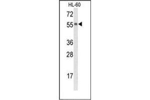 Western blot analysis of Nyctalopin Antibody (N-term) in HL-60 cell line lysates (35ug/lane). (Nyctalopin antibody  (N-Term))