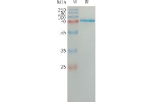 SDS-PAGE (SDS) image for Semaphorin 7A, GPI Membrane Anchor (John Milton Hagen Blood Group) (SEMA7A) (AA 45-647) protein (His tag) (ABIN7538517)