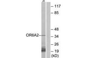 Western blot analysis of extracts from Jurkat cells, using OR6A2 Antibody. (OR6A2 antibody  (AA 58-107))
