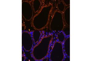 Immunofluorescence analysis of Rat thyroid using WNT5A Rabbit pAb (ABIN6134458, ABIN6150248, ABIN6150249 and ABIN6216485) at dilution of 1:100. (WNT5A antibody  (AA 250-350))