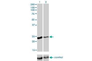 Western blot analysis of RAB4A over-expressed 293 cell line, cotransfected with RAB4A Validated Chimera RNAi (Lane 2) or non-transfected control (Lane 1). (Rab4 antibody  (AA 1-218))