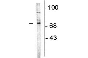 Western Blot of Anti-Choline Acetyltransferase Antibody Western Blot of Goat Anti-Choline Acetyltransferase Antibody. (Choline Acetyltransferase antibody)