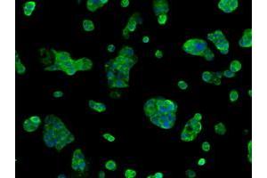 Immunofluorescent staining of HepG2 cells using anti-SORD mouse monoclonal antibody (ABIN2453678). (SORD antibody)