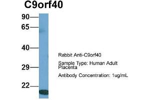 Host: Rabbit  Target Name: C9orf40  Sample Tissue: Human Adult Placenta  Antibody Dilution: 1. (C9orf40 antibody  (Middle Region))