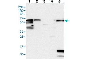 Western blot analysis of Lane 1: RT-4, Lane 2: U-251 MG, Lane 3: Human Plasma, Lane 4: Liver, Lane 5: Tonsil with ME3 polyclonal antibody .