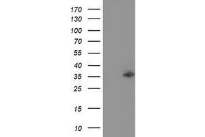 Western Blotting (WB) image for anti-Nudix (Nucleoside Diphosphate Linked Moiety X)-Type Motif 6 (NUDT6) antibody (ABIN1499871) (NUDT6 antibody)