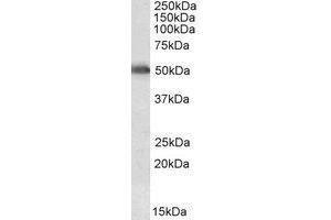 Western Blotting (WB) image for anti-Cytochrome P450, Family 2, Subfamily E, Polypeptide 1 (CYP2E1) (AA 233-243) antibody (ABIN1493874) (CYP2E1 antibody  (AA 233-243))
