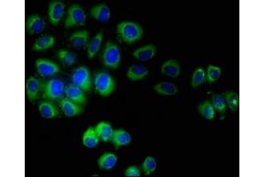 Immunofluorescent analysis of A549 cells using ABIN7173087 at dilution of 1:100 and Alexa Fluor 488-congugated AffiniPure Goat Anti-Rabbit IgG(H+L) (TMEM161B antibody  (AA 1-487))