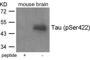 Western blot analysis of extracts from mouse brain tissue using Tau(Phospho-Ser422) Antibody and the same antibody preincubated with blocking peptide. (MAPT antibody  (pSer422))