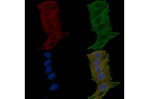 ABIN6265360 and ABIN6276804 staining Hela cells(24h of starvation treatment) by IF/ICC. (Substance P antibody  (N-Term))