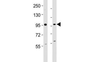 Western Blotting (WB) image for anti-Enhancer of Zeste Homolog 2 (EZH2) (AA 260-295) antibody (ABIN3030807)