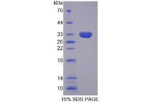 SDS-PAGE analysis of Human SLC25A13 Protein.