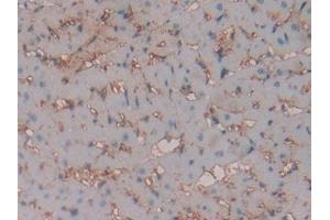 IHC-P analysis of Rat Heart Tissue, with DAB staining.
