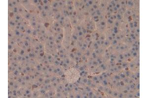 DAB staining on IHC-P; Samples: Rat Liver Tissue (Moesin antibody  (AA 353-577))