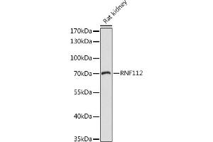 Western blot analysis of extracts of Rat kidney, using RNF112 antibody (ABIN7270054) at 1:1000 dilution. (RNF112 antibody  (AA 200-500))
