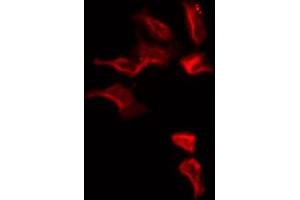 ABIN6274813 staining HepG2 by IF/ICC. (SLC25A6 antibody  (Internal Region))