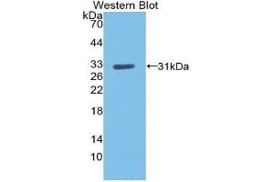 Western Blotting (WB) image for anti-Low Density Lipoprotein Receptor (LDLR) (AA 497-742) antibody (ABIN1868939) (LDLR antibody  (AA 497-742))