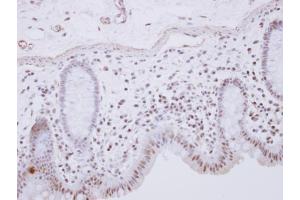 IHC-P Image RCL1 antibody [N1C3] detects RCL1 protein at nucleus on human normal colon by immunohistochemical analysis. (RCL1 antibody)