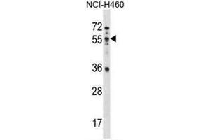 MEX3B Antibody (N-term) western blot analysis in NCI-H460 cell line lysates (35µg/lane). (MEX3B antibody  (N-Term))