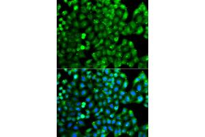 Immunofluorescence analysis of A549 cells using HLA-DRB1 antibody. (HLA-DRB1 antibody)