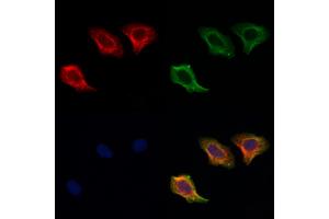ABIN6256906 and ABIN6274857 staining Hela cells by IF/ICC.
