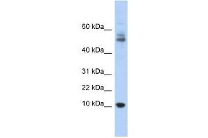 Myotrophin antibody used at 1 ug/ml to detect target protein. (MTPN antibody  (Middle Region))