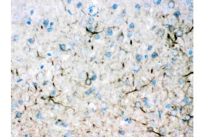 Alpha Internexin was detected in paraffin-embedded sections of mouse brain tissues using rabbit anti- Alpha Internexin Antigen Affinity purified polyclonal antibody (Catalog # ) at 1 µg/mL.