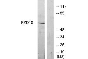 Western blot analysis of extracts from COS-7 cells, using FZD10 antibody. (FZD10 antibody  (Internal Region))